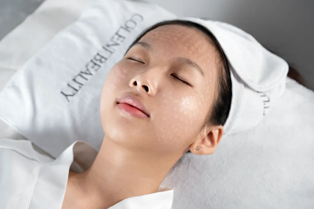 Hydration Meso featured image at Coleni Beauty Da Nang — photo 2 of 3