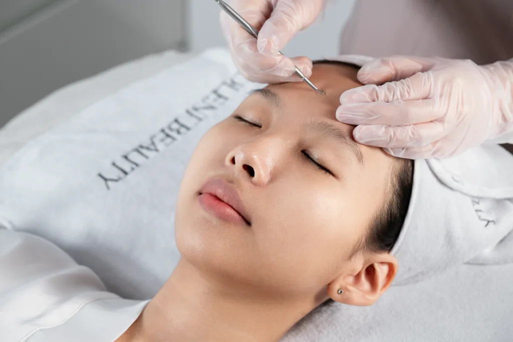 Derma Acnes featured image at Coleni Beauty Da Nang — photo 2 of 3